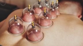 Ganzkörpermassage 60 Min. + Schröpfen