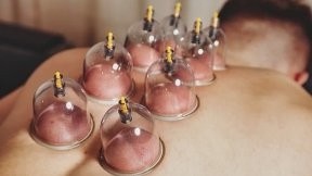 Rückenmassage mit Schröpfen