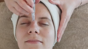 Gutschein Microneedling-Treatment (Gesicht, Hals + Dekolleté)